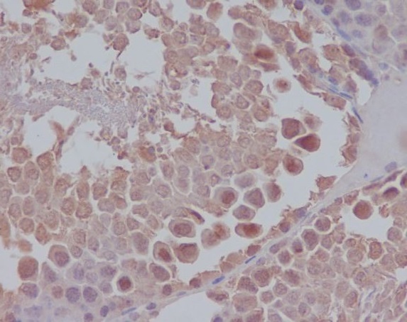 2 - Anti-Nanog Rabbit Monoclonal Antibody ABO13655
