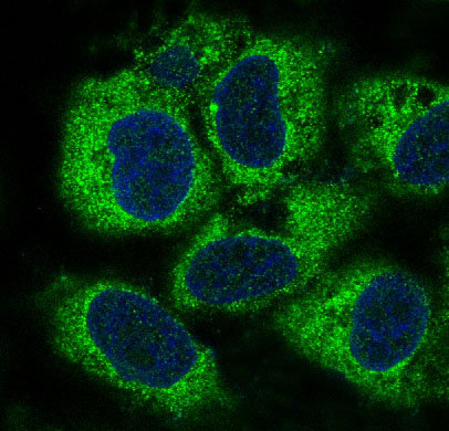 3 - Anti-PEBP1/Pbp Rabbit Monoclonal Antibody ABO13656