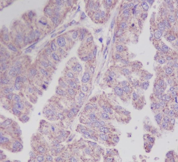 2 - Anti-PEBP1/Pbp Rabbit Monoclonal Antibody ABO13656