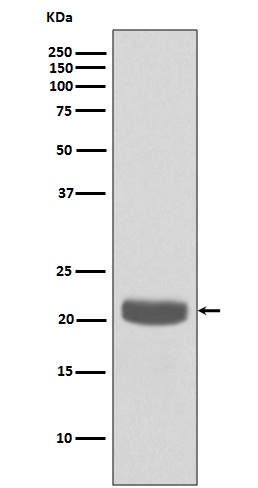1 - Anti-PEBP1/Pbp Rabbit Monoclonal Antibody ABO13656