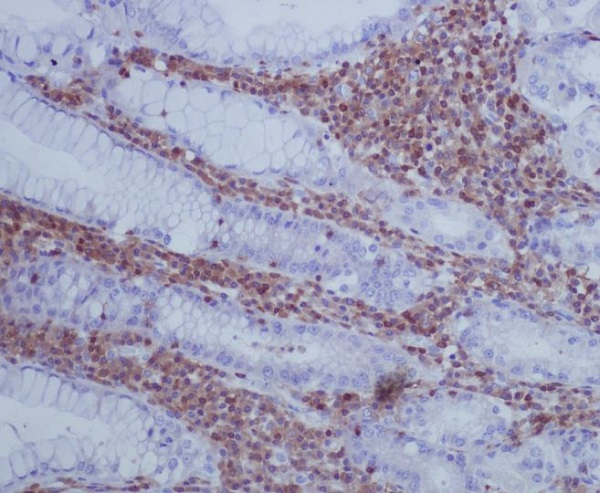 2 - Anti-GAP43 Rabbit Monoclonal Antibody ABO13657