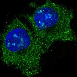 3 - Anti-eIF5A Rabbit Monoclonal Antibody ABO13658