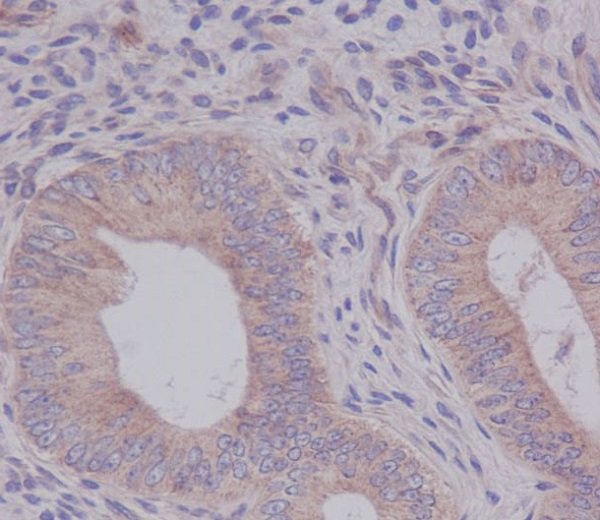 2 - Anti-eIF5A Rabbit Monoclonal Antibody ABO13658
