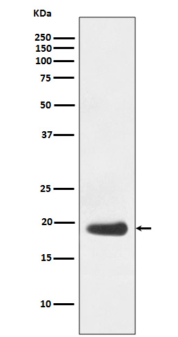 1 - Anti-eIF5A Rabbit Monoclonal Antibody ABO13658