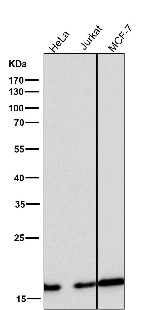 1 - Anti-eIF5A Rabbit Monoclonal Antibody ABO13658