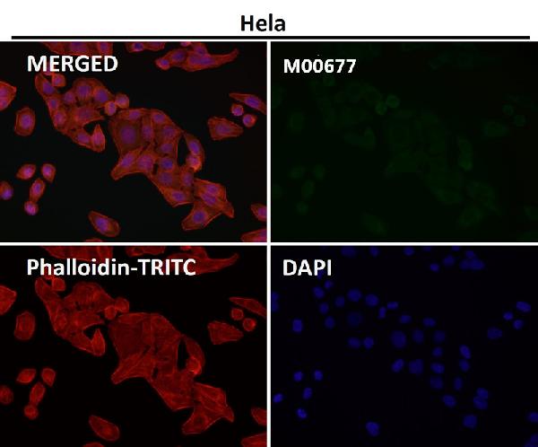 1 - Anti-PLCG1/Plc Gamma 1 Rabbit Monoclonal Antibody ABO13659
