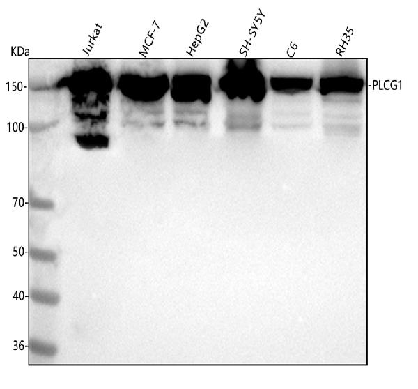 1 - Anti-PLCG1/Plc Gamma 1 Rabbit Monoclonal Antibody ABO13659