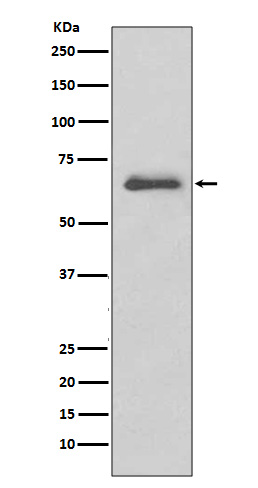 1 - Anti-IRAK3/Irak M Rabbit Monoclonal Antibody ABO13661