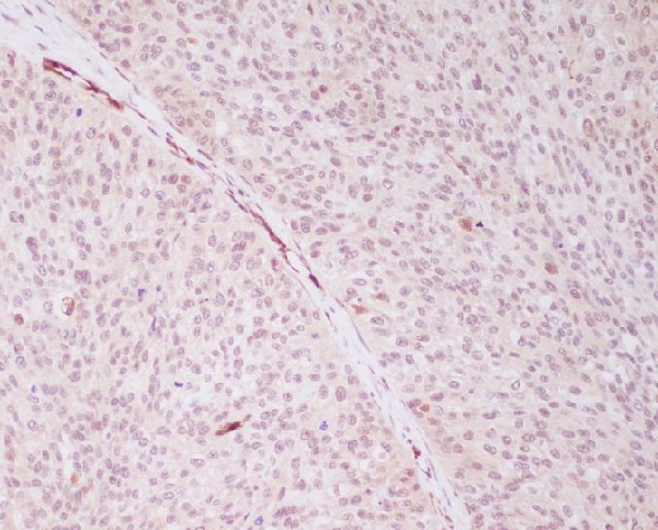 2 - Anti-PRP19 PRPF19 Rabbit Monoclonal Antibody ABO13662