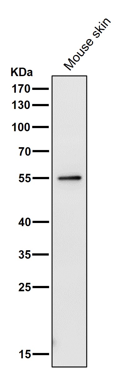 1 - Anti-PRP19 PRPF19 Rabbit Monoclonal Antibody ABO13662