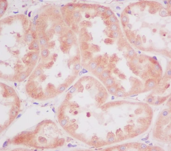 2 - Anti-RPS20/Ribosomal Protein S20 Rabbit Monoclonal Antibody ABO13663