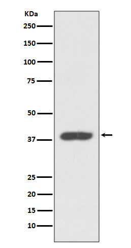 1 - Anti-CXCR7 ACKR3 Rabbit Monoclonal Antibody ABO13664