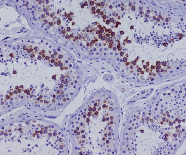 2 - Anti-CD168 HMMR Rabbit Monoclonal Antibody ABO13665