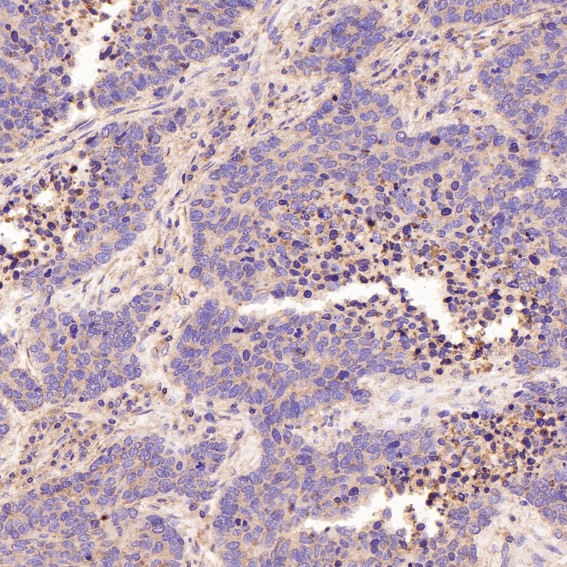 2 - Anti-CD168 HMMR Rabbit Monoclonal Antibody ABO13665