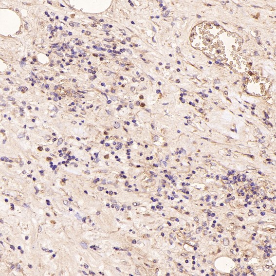 2 - Anti-CD168 HMMR Rabbit Monoclonal Antibody ABO13665