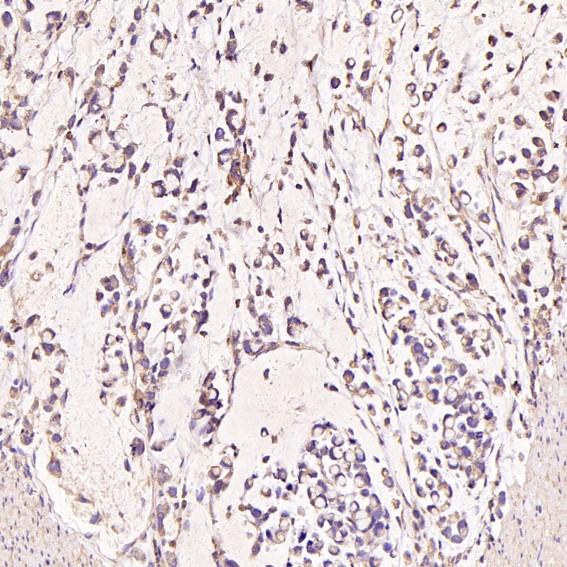 2 - Anti-CD168 HMMR Rabbit Monoclonal Antibody ABO13665