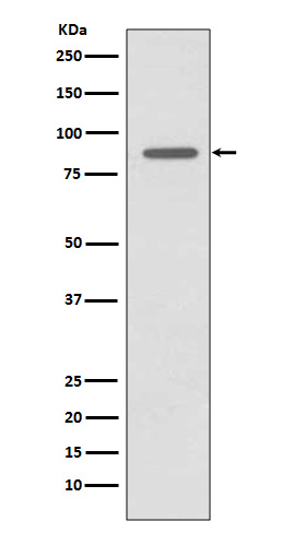 1 - Anti-CD168 HMMR Rabbit Monoclonal Antibody ABO13665
