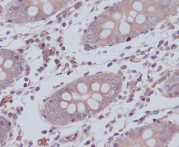 2 - Anti-WASF2 Rabbit Monoclonal Antibody ABO13667