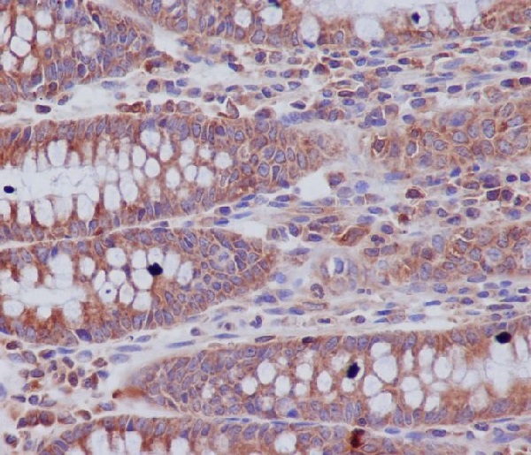 2 - Anti-ABCF1 Rabbit Monoclonal Antibody ABO13669