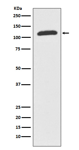 1 - Anti-ABCF1 Rabbit Monoclonal Antibody ABO13669