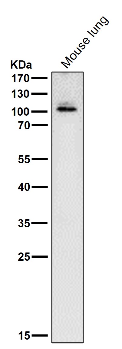 1 - Anti-ABCF1 Rabbit Monoclonal Antibody ABO13669