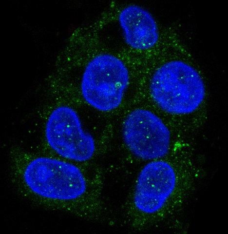 3 - Anti-ATG9A Rabbit Monoclonal Antibody ABO13670