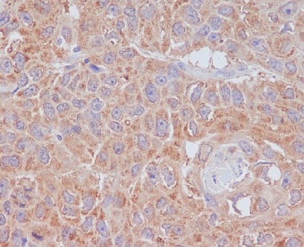 2 - Anti-ATG9A Rabbit Monoclonal Antibody ABO13670