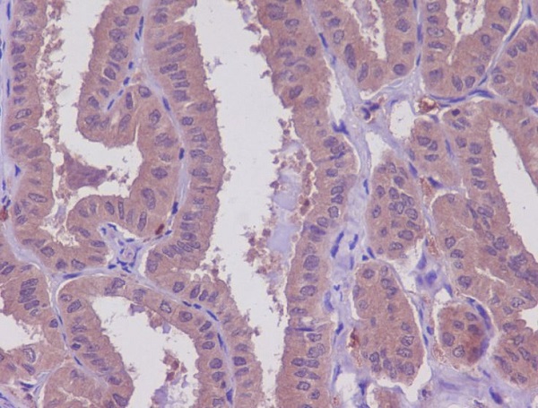 2 - Anti-MEKK2 MAP3K2 Rabbit Monoclonal Antibody ABO13671