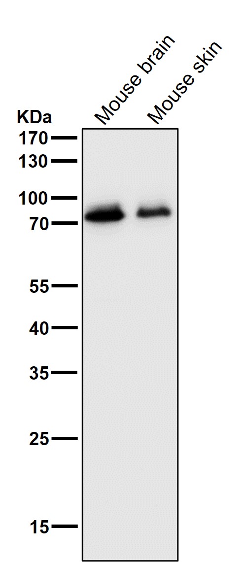 1 - Anti-MEKK2 MAP3K2 Rabbit Monoclonal Antibody ABO13671