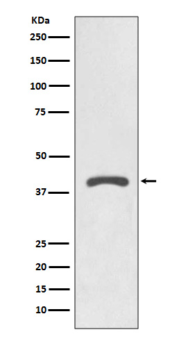 1 - Anti-AGTR2/Angiotensin Ii Type 2 Receptor Rabbit Monoclonal Antibody ABO13673