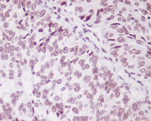 2 - Anti-PARK7/Dj 1 Rabbit Monoclonal Antibody ABO13675