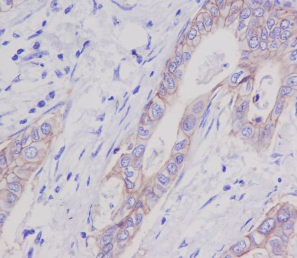 2 - Anti-EpCAM/Trop1 Rabbit Monoclonal Antibody ABO13676