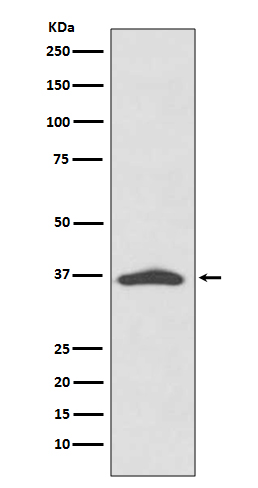 1 - Anti-EpCAM/Trop1 Rabbit Monoclonal Antibody ABO13676
