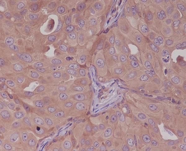 2 - Anti-Bcl10 Rabbit Monoclonal Antibody ABO13677