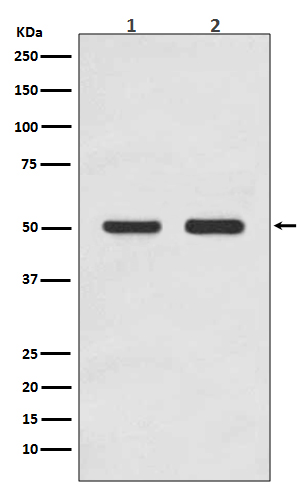 1 - Anti-AP2M1/Ap 2 Mu 1 Rabbit Monoclonal Antibody ABO13678