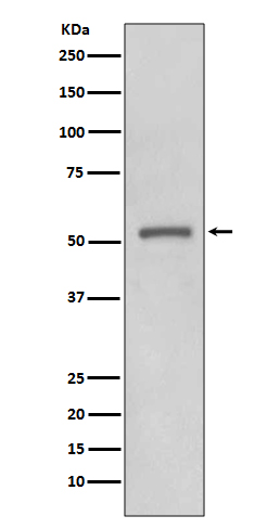 1 - Anti-MMP11 Rabbit Monoclonal Antibody ABO13679