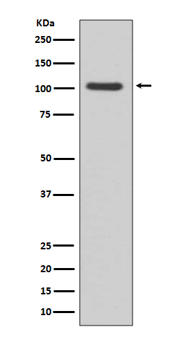 1 - Anti-GluR1 GRIA1 Rabbit Monoclonal Antibody ABO13682