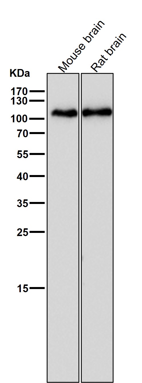 1 - Anti-GluR1 GRIA1 Rabbit Monoclonal Antibody ABO13682