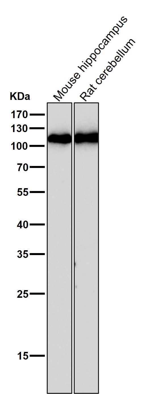 1 - Anti-GluR1 GRIA1 Rabbit Monoclonal Antibody ABO13682