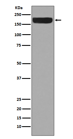 1 - Anti-ErbB4/Her4 Rabbit Monoclonal Antibody ABO13683
