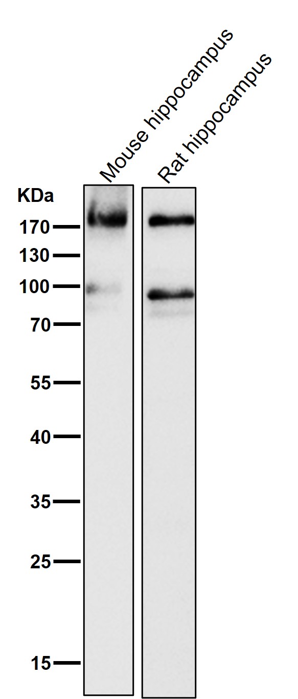 1 - Anti-ErbB4/Her4 Rabbit Monoclonal Antibody ABO13683