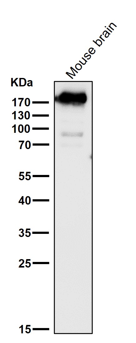 1 - Anti-ErbB4/Her4 Rabbit Monoclonal Antibody ABO13683