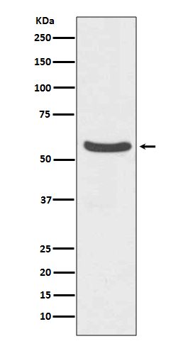 1 - Anti-GLUT2 Rabbit Monoclonal Antibody ABO13684