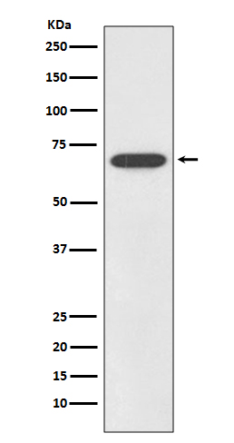 1 - Anti-SOX11 Rabbit Monoclonal Antibody ABO13685