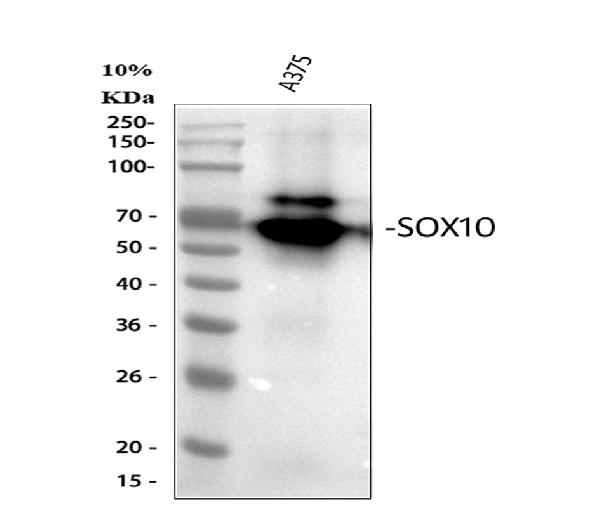1 - Anti-SOX10 Rabbit Monoclonal Antibody ABO13686