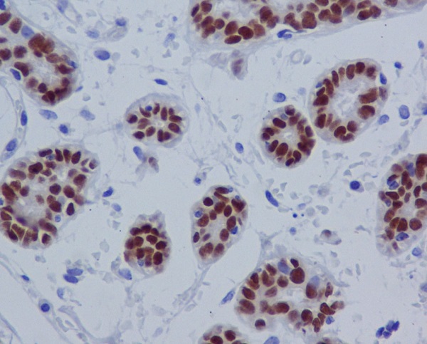 2 - Anti-SOX10 Rabbit Monoclonal Antibody ABO13687