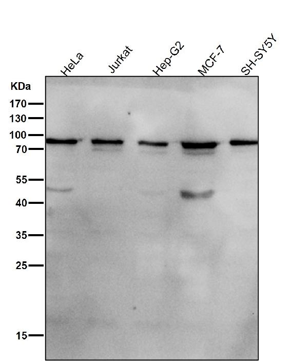1 - Anti-SOX10 Rabbit Monoclonal Antibody ABO13687