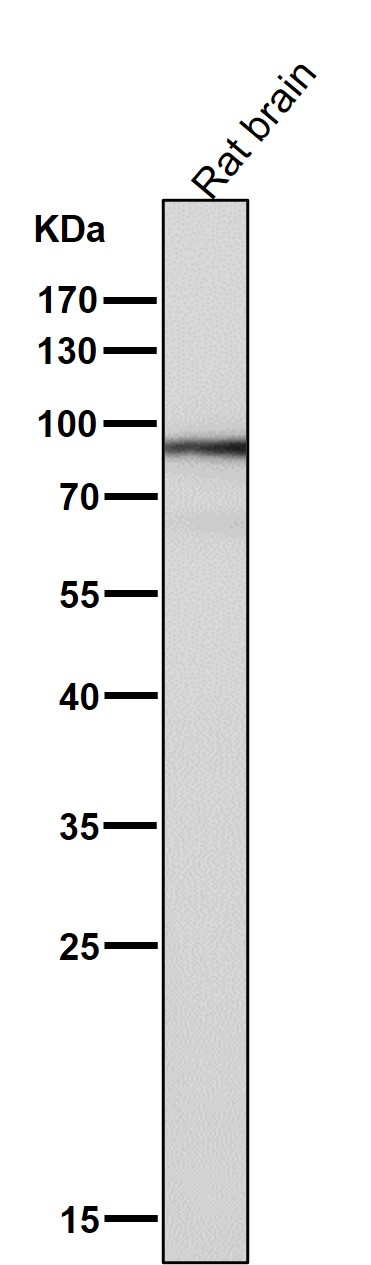 1 - Anti-SOX10 Rabbit Monoclonal Antibody ABO13687