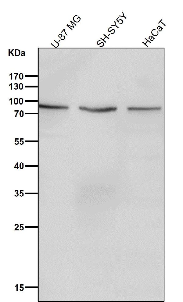 1 - Anti-SOX10 Rabbit Monoclonal Antibody ABO13687