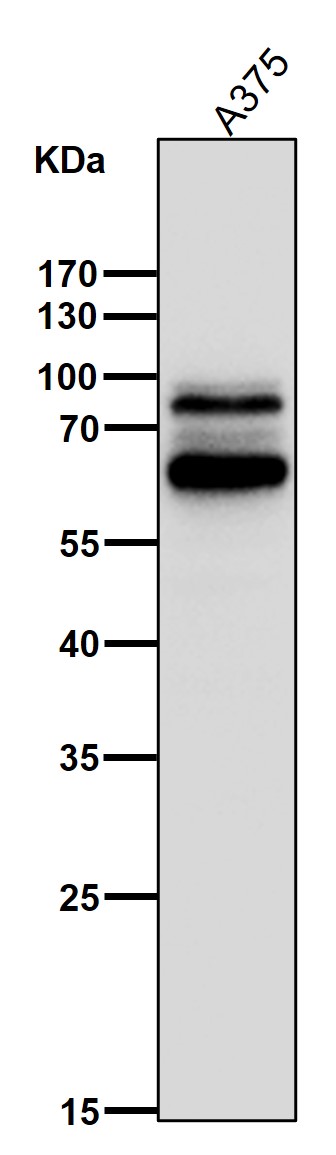 1 - Anti-SOX10 Rabbit Monoclonal Antibody ABO13687